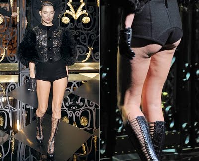 Celulite: Elas Também Tem! kate moss Celulite: Elas Também Tem!