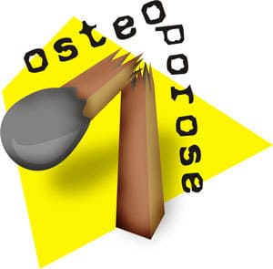 s6 - Osteoporose...se cuide desde já