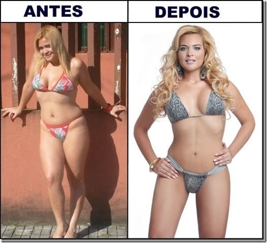 Lipoescultura-antes-e-depois