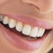 sensibilidade-dentes