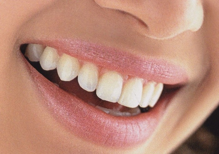 sensibilidade dentes - Como acabar com a sensibilidade nos dentes?
