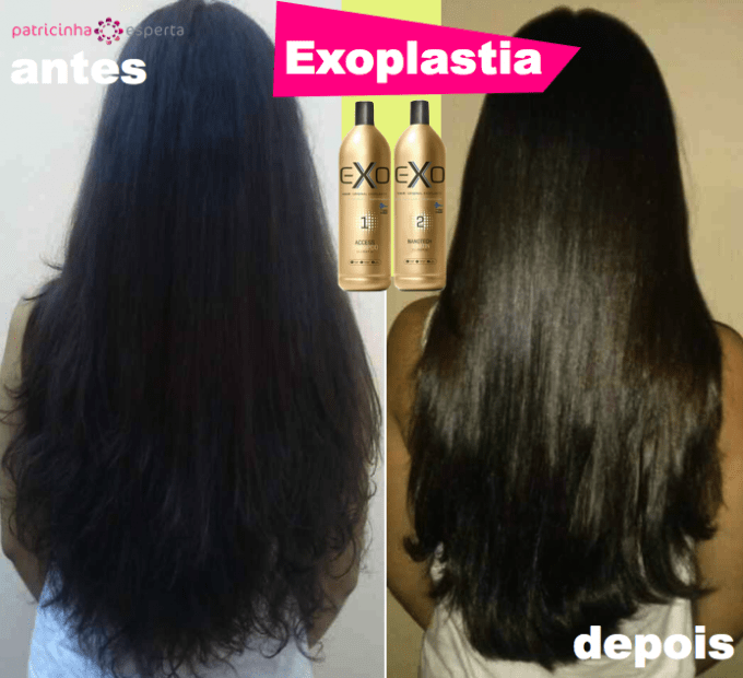 exoplastia.001 680x620 Exoplastia Exo Hair: O que é? Como usar? Antes e Depois!