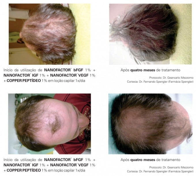 nssss 680x611 - Fatores de crescimento para cabelos, cílios e mais