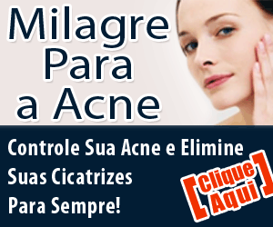 Ebook Milagre Para a Acne Milagre Para a Acne